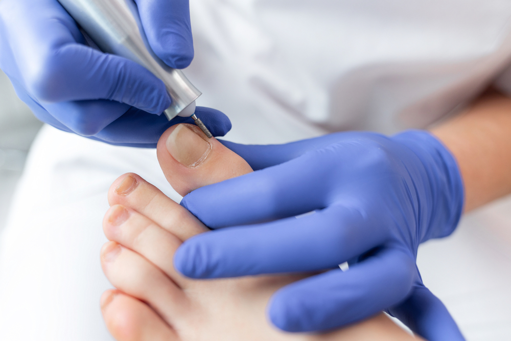 Medische Pedicure